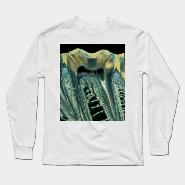 Tooth, light micrograph (C028/6621) Long Sleeve T-Shirt by SciencePhoto